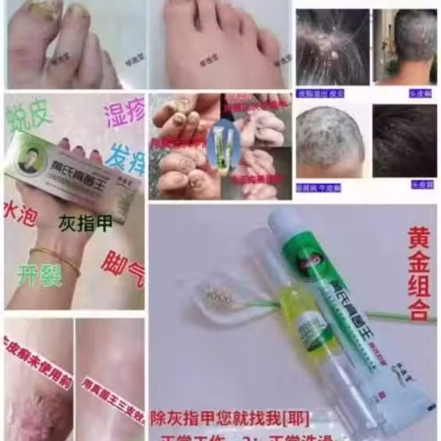黄氏真菌王牙膏 图片 6