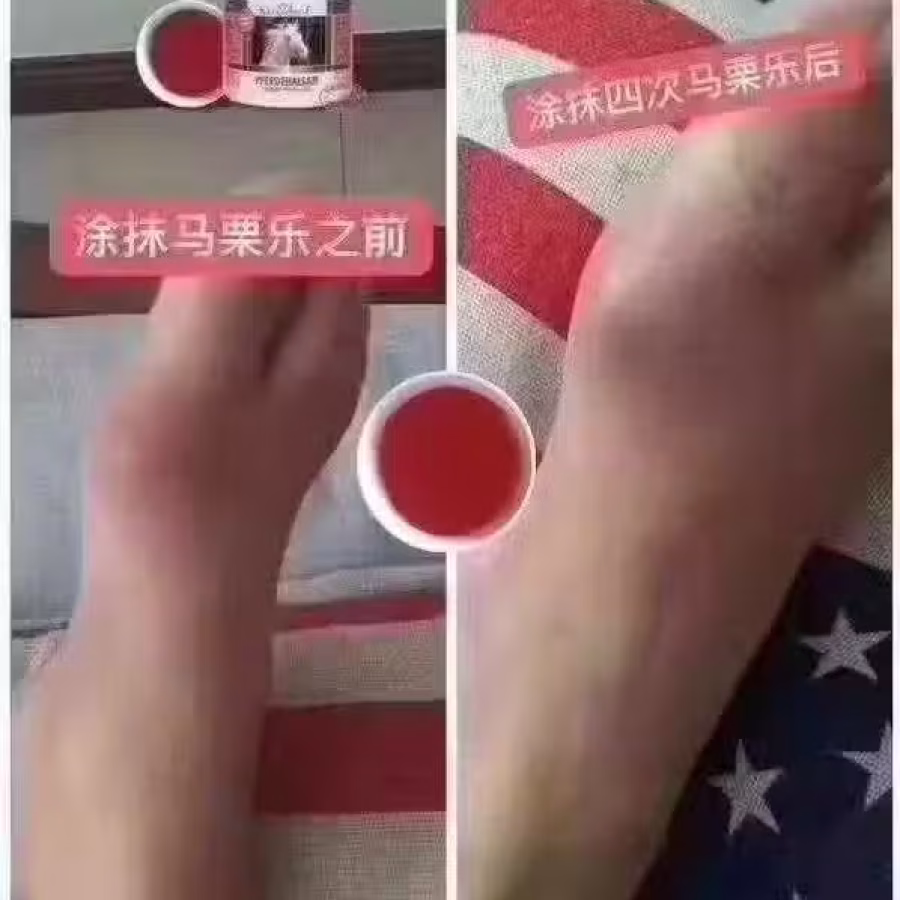 马粟乐按摩凝胶 图片 4