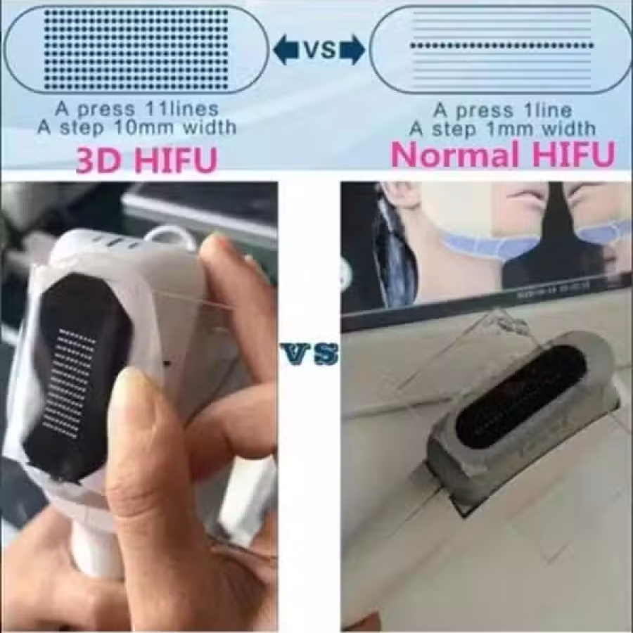 4D HIFU 超声刀 图片 10