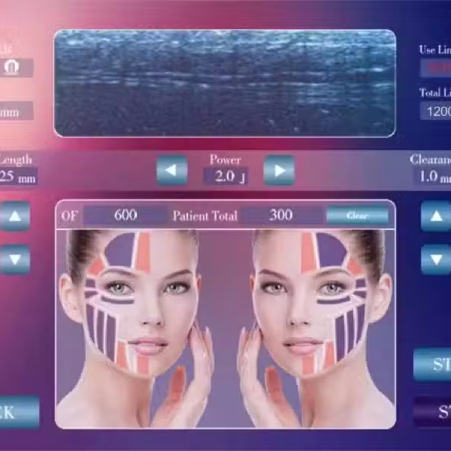 4D HIFU 超声刀 图片 9